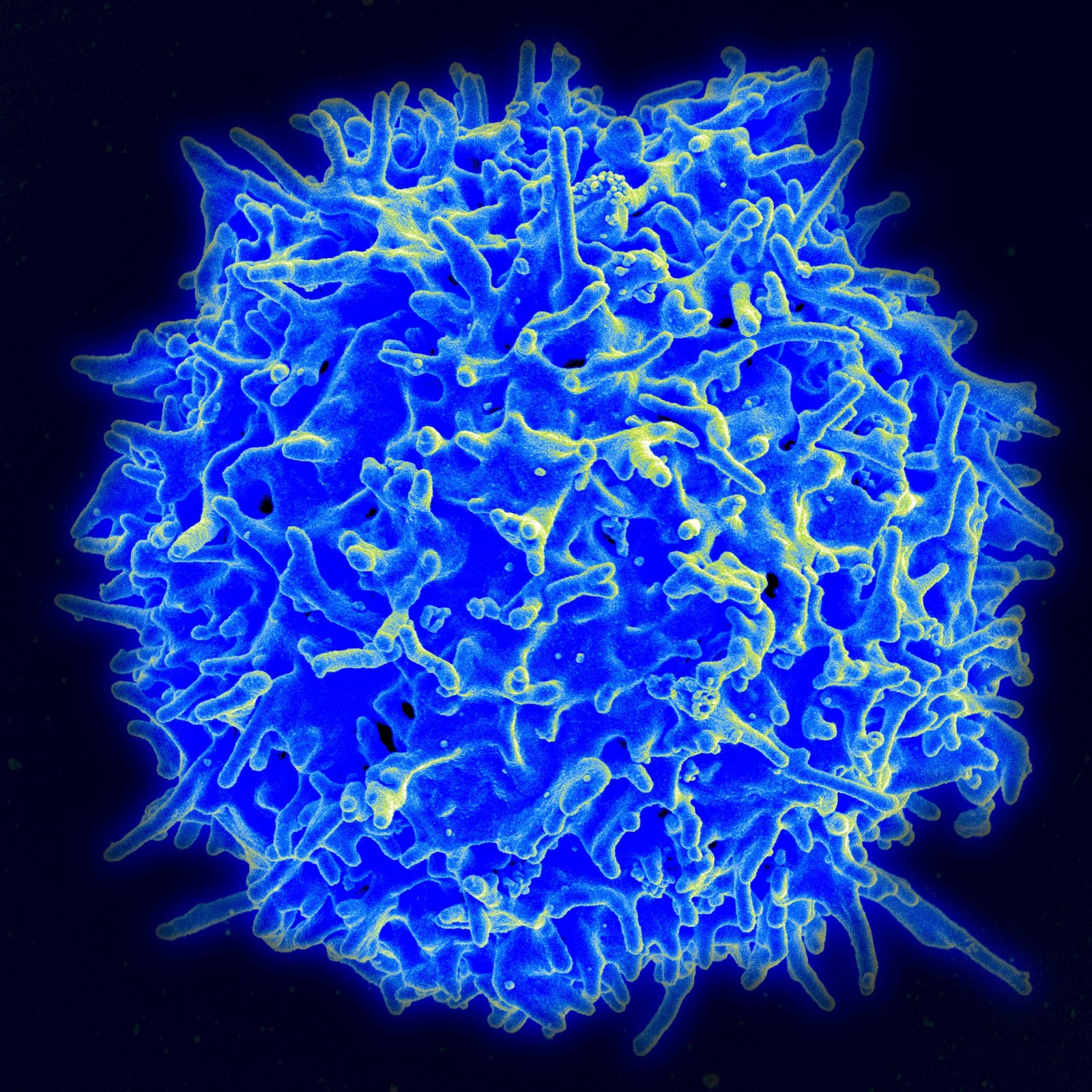 A scanning electron micrograph of a human T lymphocyte — the kind of immune cell at the centre of the dataset GPT-5 was asked to explain.